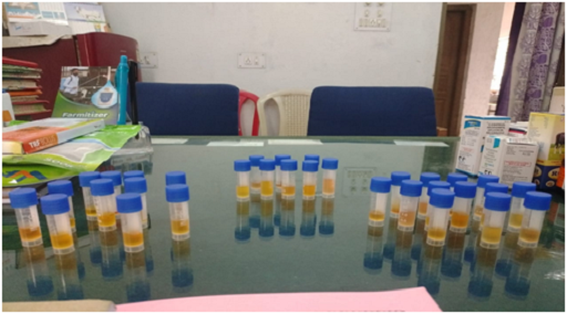 Blood Serum Sample Collection from Cattle Blood Serum Sample Collection from Cattle